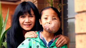 DEER PARK: Restoring Linh Da’s smile