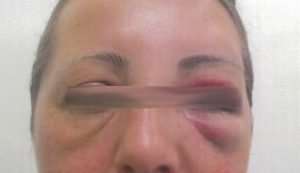 Woman punched in head over Highpoint parking spot