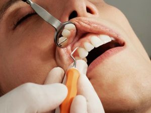 Dental wait times could worsen