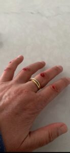 Steep ramps a station safety hazard