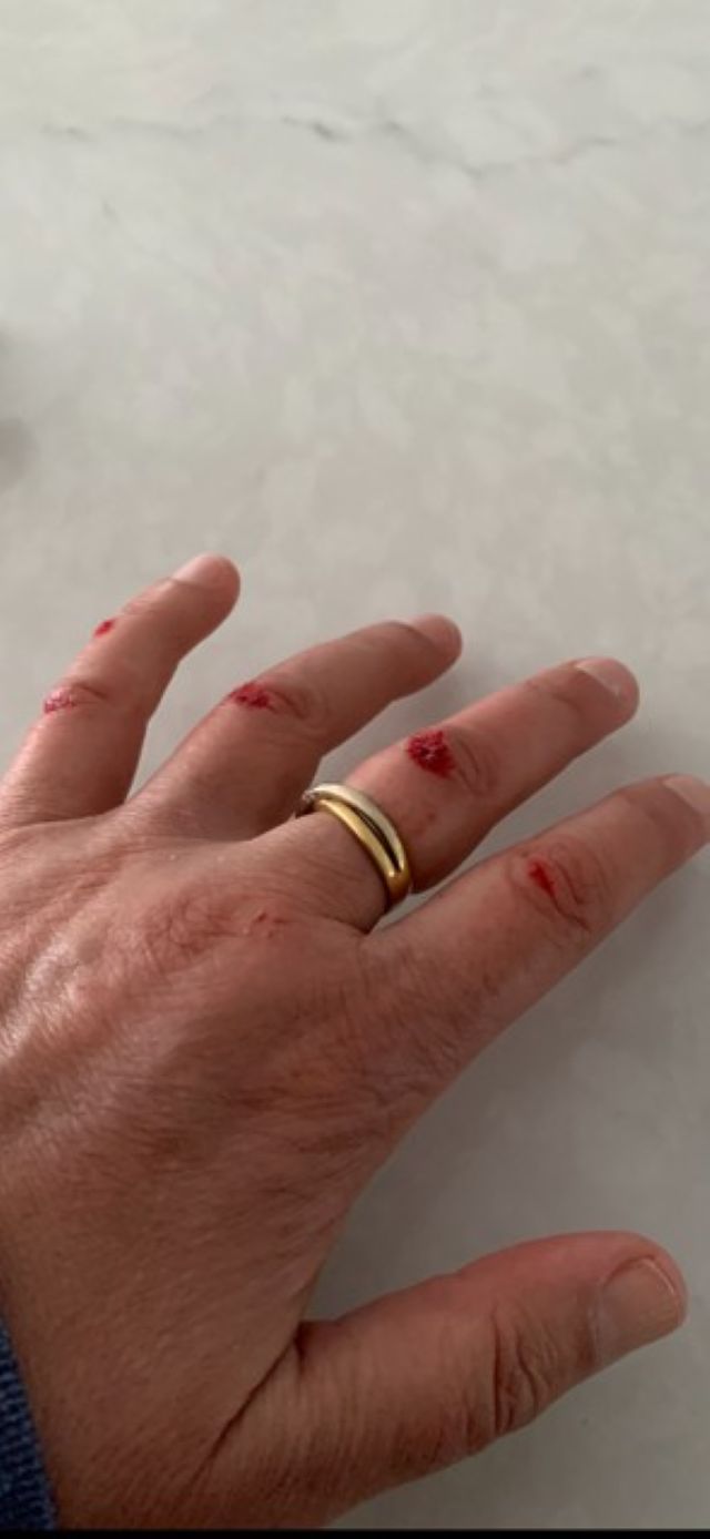 Steep ramps a station safety hazard