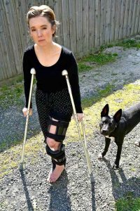 Leg broken in dog attack